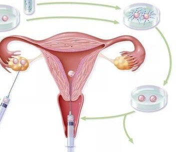 2026年上海十大试管医院排名，来看看患者选择指南