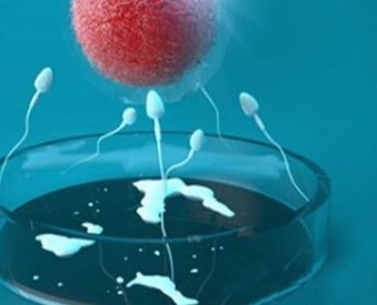 (广东做试管婴儿的价格)广州南方医院试管婴儿费用清单